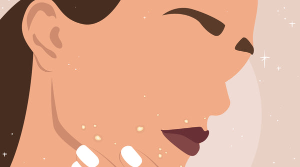 Skin Care and Your Cycle: Our Top Tips For Dealing With Hormonal Acne